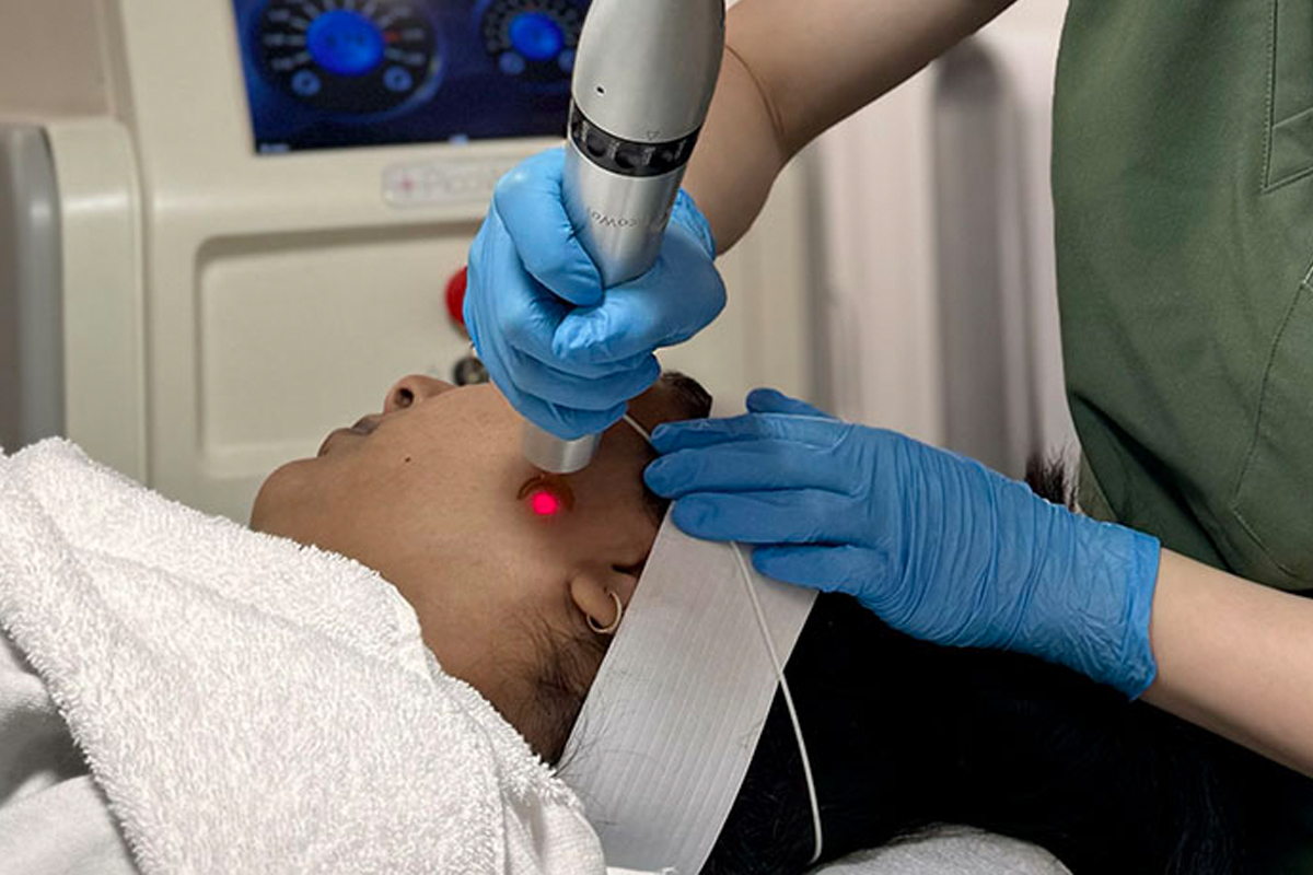 Rejuvenation treatment with the PicoWay Resolve at Studio Kiku