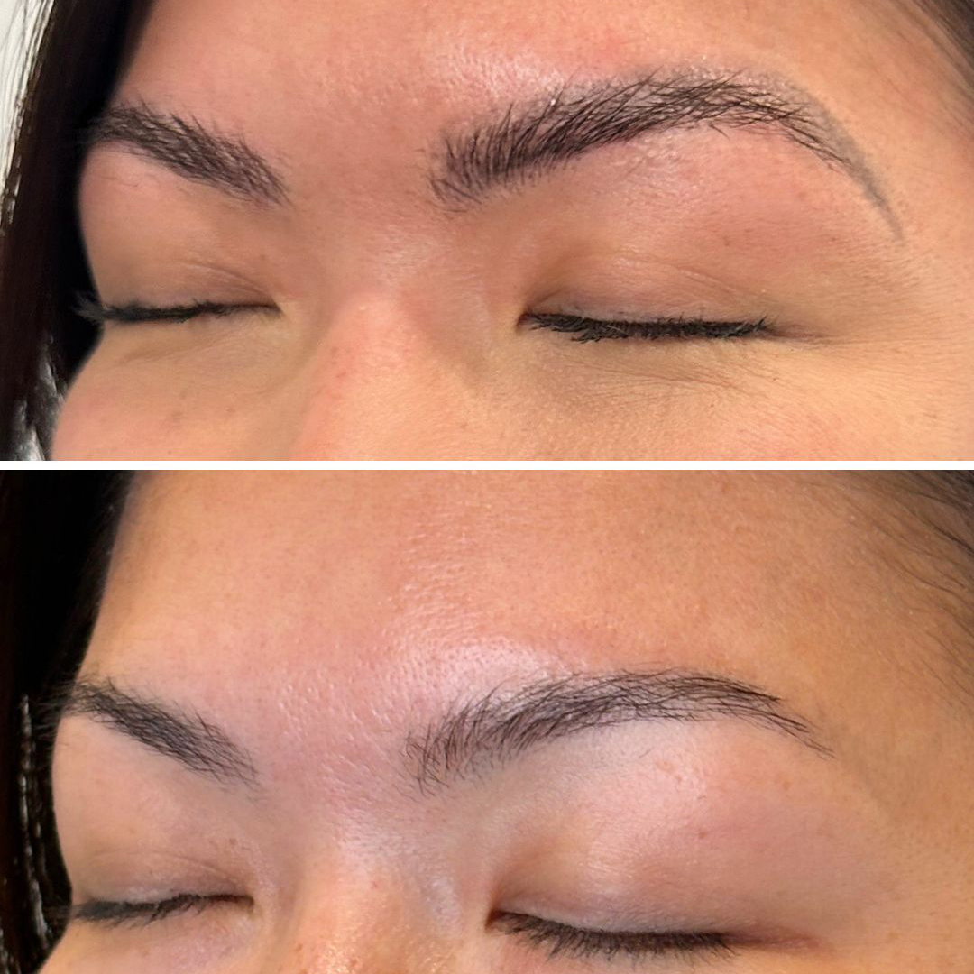 PMU brow removal — 1 session