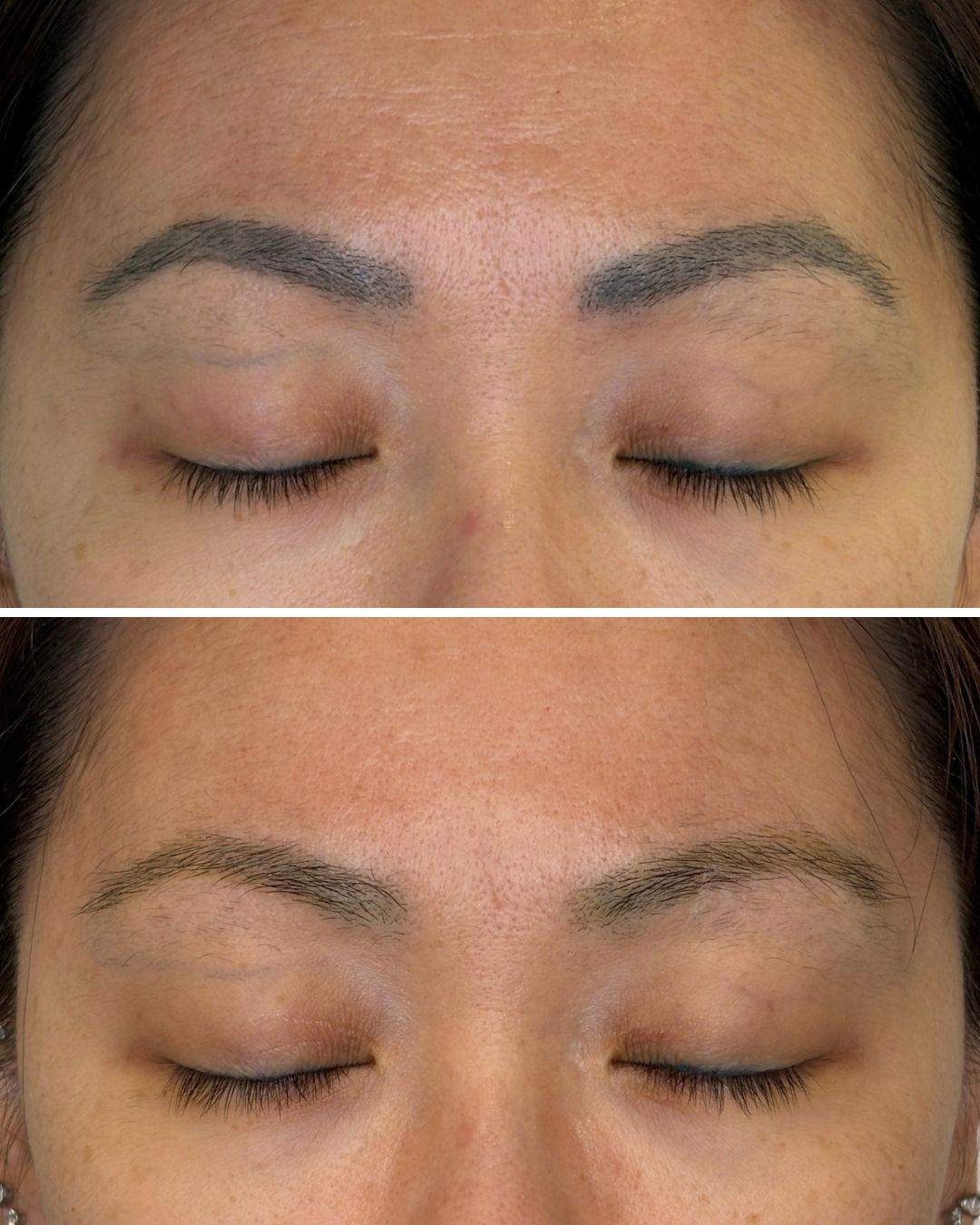 PMU brow removal — 1 session