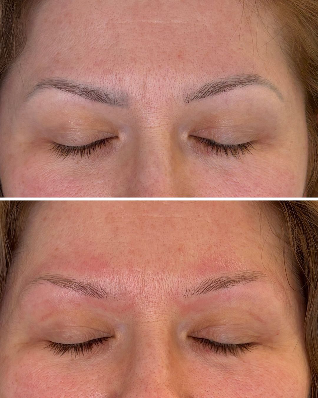 PMU brow removal — 1 session